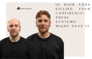 Hair Loss